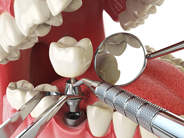 Best Emergency Care for Gum Disease in Cambridge, IL