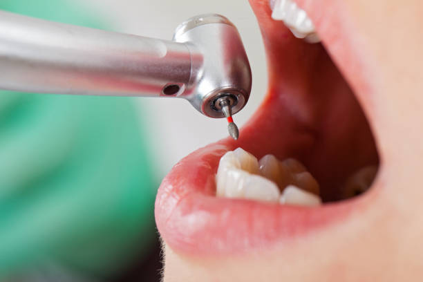 Best Walk-In Emergency Dental Services in Cambridge, IL